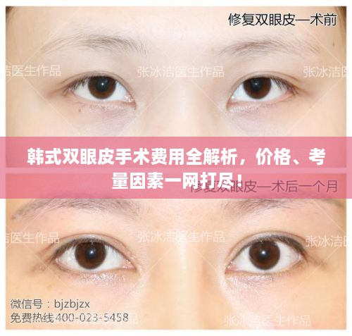 韓式雙眼皮手術(shù)費(fèi)用全解析，價格、考量因素一網(wǎng)打盡！