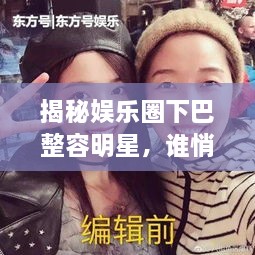 揭秘娛樂(lè)圈下巴整容明星，誰(shuí)悄悄整過(guò)下巴？