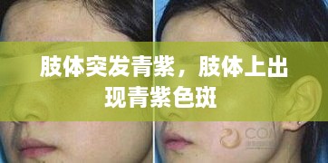 肢體突發(fā)青紫，肢體上出現(xiàn)青紫色斑 