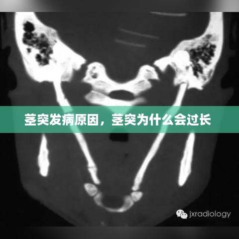 莖突發(fā)病原因，莖突為什么會(huì)過(guò)長(zhǎng) 