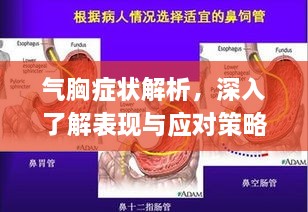 氣胸癥狀解析，深入了解表現(xiàn)與應對策略