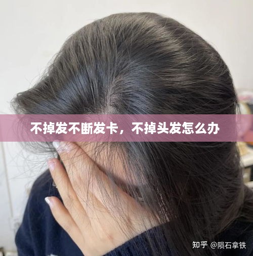不掉發(fā)不斷發(fā)卡，不掉頭發(fā)怎么辦 