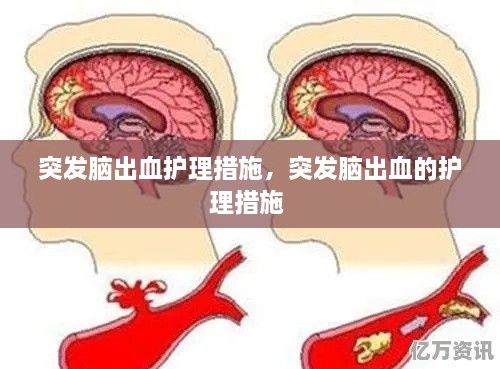 突發(fā)腦出血護(hù)理措施，突發(fā)腦出血的護(hù)理措施 