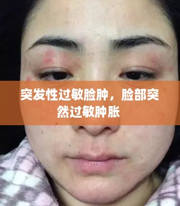 突發(fā)性過(guò)敏臉腫，臉部突然過(guò)敏腫脹 