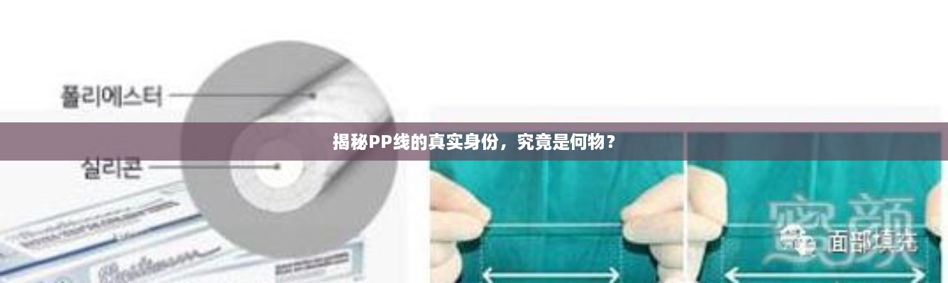 揭秘PP線的真實(shí)身份，究竟是何物？