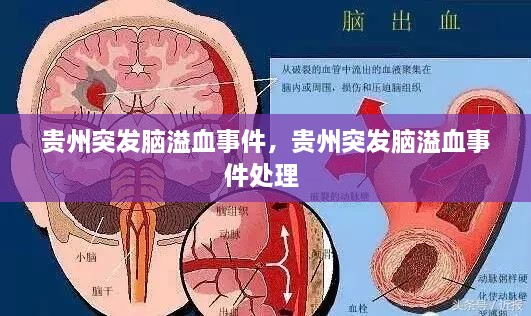 貴州突發(fā)腦溢血事件，貴州突發(fā)腦溢血事件處理 