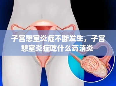 子宮憩室炎癥不斷發(fā)生，子宮憩室炎癥吃什么藥消炎 