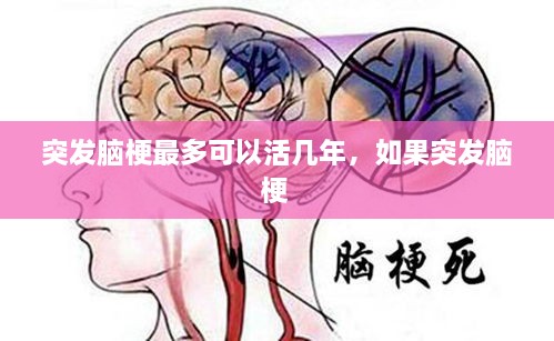 突發(fā)腦梗最多可以活幾年，如果突發(fā)腦梗 
